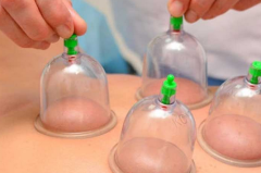 Kupa Çekme Bardağı